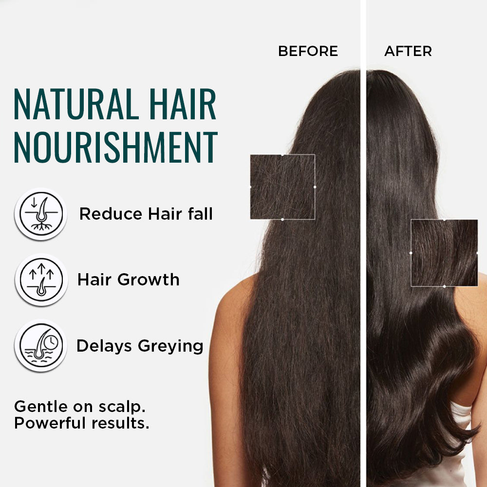Keshindra Hair Oil